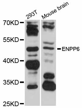 ENPP6 Antibody - Western blot analysis of extracts of various cell lines, using ENPP6 antibody at 1:1000 dilution. The secondary antibody used was an HRP Goat Anti-Rabbit IgG (H+L) at 1:10000 dilution. Lysates were loaded 25ug per lane and 3% nonfat dry milk in TBST was used for blocking. An ECL Kit was used for detection and the exposure time was 30s.
