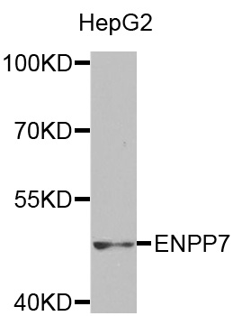 ENPP7 Antibody - Western blot analysis of extracts of HepG2 cells.