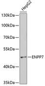 ENPP7 Antibody - Western blot analysis of extracts of HepG2 cells using ENPP7 Polyclonal Antibody at dilution of 1:400.