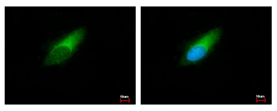 ENSA Antibody - ENSA antibody detects ENSA protein at cytoplasm by immunofluorescent analysis. HeLa cells were fixed in ice-cold Methanol for 5 min. ENSA protein stained by ENSA antibody diluted at 1:500.