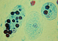 Entamoeba histolytica Antibody - Trophozoites of Entamoeba histolytica with ingested erythrocytes