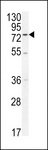 ENTHD1 Antibody - ENTHD1 Antibody western blot of A2058 cell line lysates (35 ug/lane). The ENTHD1 antibody detected the ENTHD1 protein (arrow).