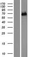 ENTHD1 Protein - Western validation with an anti-DDK antibody * L: Control HEK293 lysate R: Over-expression lysate