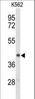 ENTPD2 Antibody - Western blot of ENTPD2 Antibody in K562 cell line lysates (35 ug/lane). ENTPD2 (arrow) was detected using the purified antibody.