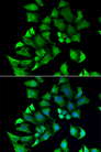 ENTPD2 Antibody - Immunofluorescence analysis of A549 cells.