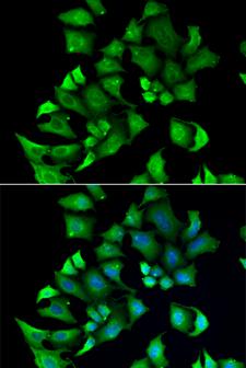 ENTPD2 Antibody - Immunofluorescence analysis of A549 cells.