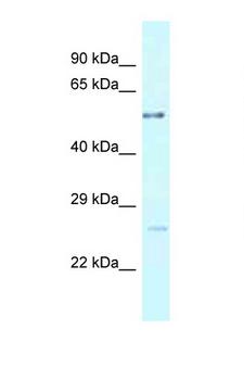 ENTPD3 Antibody - ENTPD3 antibody Western blot of Fetal Lung lysate. Antibody concentration 1 ug/ml.  This image was taken for the unconjugated form of this product. Other forms have not been tested.
