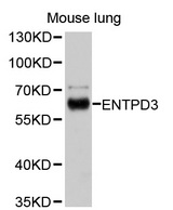 ENTPD3 Antibody - Western blot analysis of extracts of mouse lung, using ENTPD3 antibody at 1:1000 dilution. The secondary antibody used was an HRP Goat Anti-Rabbit IgG (H+L) at 1:10000 dilution. Lysates were loaded 25ug per lane and 3% nonfat dry milk in TBST was used for blocking. An ECL Kit was used for detection and the exposure time was 10s.