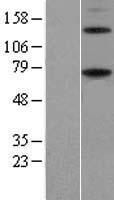 ENTPD4 / LALP70 Protein - Western validation with an anti-DDK antibody * L: Control HEK293 lysate R: Over-expression lysate
