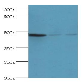 ENTPD5 / CD39L4 Antibody - Western blot. All lanes: ENTPD5 antibody at 4 ug/ml. Lane 1: mouse liver tissue. Lane 2: mouse kidney tissue. Lane 3: mouse gonad tissue. Secondary antibody: Goat polyclonal to rabbit at 1:10000 dilution. Predicted band size: 48 kDa. Observed band size: 48 kDa.