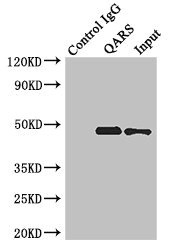 ENTPD5 / CD39L4 Antibody - Immunoprecipitating ENTPD5 in Hela whole cell lysate Lane 1: Rabbit monoclonal IgG (1µg) instead of ENTPD5 Antibody in Hela whole cell lysate.For western blotting, a HRP-conjugated anti-rabbit IgG, specific to the non-reduced form of IgG was used as the Secondary antibody (1/50000) Lane 2: ENTPD5 Antibody (4µg) + Hela whole cell lysate (500µg) Lane 3: Hela whole cell lysate (20µg)
