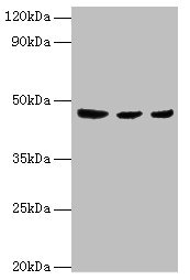 ENTPD5 / CD39L4 Antibody - Western blot All lanes: ENTPD5 antibody at 4µg/ml Lane 1: Mouse liver tissue Lane 2: Mouse kidney tissue Lane 3: Mouse gonad tissue Secondary Goat polyclonal to rabbit IgG at 1/10000 dilution Predicted band size: 48 kDa Observed band size: 48 kDa