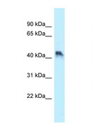ENTPD5 / CD39L4 Antibody - ENTPD5 antibody Western blot of HT1080 Cell lysate. Antibody concentration 1 ug/ml.  This image was taken for the unconjugated form of this product. Other forms have not been tested.