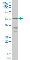 ENTPD5 / CD39L4 Antibody - ENTPD5 monoclonal antibody (M07), clone 4A5 Western Blot analysis of ENTPD5 expression in HepG2.