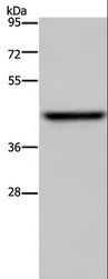 ENTPD5 / CD39L4 Antibody - Western blot analysis of Mouse liver tissue, using ENTPD5 Polyclonal Antibody at dilution of 1:500.