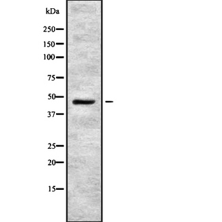 ENTPD5 / CD39L4 Antibody - Western blot analysis of ENTPD5 using COS7 whole lysates.