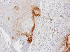 ENTPD6 Antibody - IHC of paraffin-embedded Ca922 xenograft using ENTPD6 antibody at 1:100 dilution.