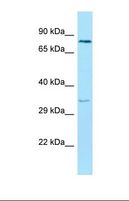 ENTPD6 Antibody - Western blot of Human Hela. ENTPD6 antibody dilution 1.0 ug/ml.  This image was taken for the unconjugated form of this product. Other forms have not been tested.