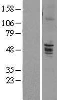 ENTPD6 Protein - Western validation with an anti-DDK antibody * L: Control HEK293 lysate R: Over-expression lysate