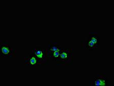 ENTPD7 Antibody - Immunofluorescent analysis of Hela cells using ENTPD7 Antibody at dilution of 1:100 and Alexa Fluor 488-congugated AffiniPure Goat Anti-Rabbit IgG(H+L)