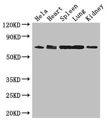 ENTPD7 Antibody - Western Blot Positive WB detected in: Hela whole cell lysate, Mouse heart tissue, Mouse spleen tissue, Mouse lung tissue, Mouse kidney tissue All lanes: ENTPD7 antibody at 2.8µg/ml Secondary Goat polyclonal to rabbit IgG at 1/50000 dilution Predicted band size: 69 kDa Observed band size: 69 kDa