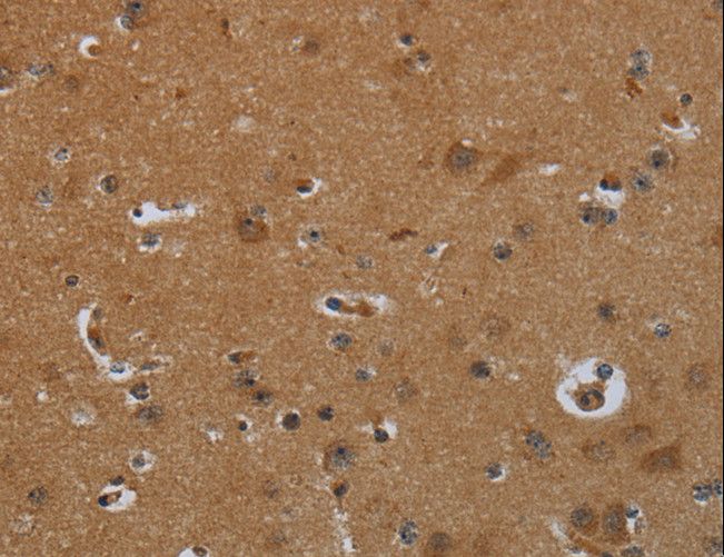 ENTPD7 Antibody - Immunohistochemistry of paraffin-embedded Human brain using ENTPD7 Polyclonal Antibody at dilution of 1:60.
