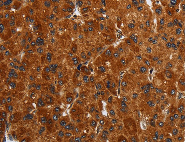ENTPD7 Antibody - Immunohistochemistry of paraffin-embedded Human brain using ENTPD7 Polyclonal Antibody at dilution of 1:40.