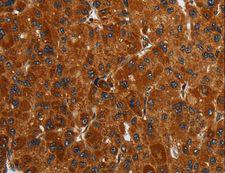 ENTPD7 Antibody - Immunohistochemistry of paraffin-embedded Human brain using ENTPD7 Polyclonal Antibody at dilution of 1:40.