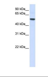 ENTPD8 Antibody - Fetal lung lysate. Antibody concentration: 1.0 ug/ml. Gel concentration: 12%.  This image was taken for the unconjugated form of this product. Other forms have not been tested.