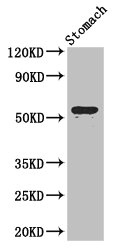 ENTPD8 Antibody - Western Blot Positive WB detected in: Mouse stomach tissue All lanes: ENTPD8 antibody at 2µg/ml Secondary Goat polyclonal to rabbit IgG at 1/50000 dilution Predicted band size: 54, 50 kDa Observed band size: 54 kDa