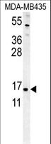 ENY2 Antibody - ENY2 Antibody western blot of MDA-MB435 cell line lysates (35 ug/lane). The ENY2 antibody detected the ENY2 protein (arrow).