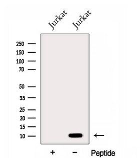 ENY2 Antibody - Western blot analysis of extracts of Jurkat cells using ENY2 antibody. The lane on the left was treated with blocking peptide.
