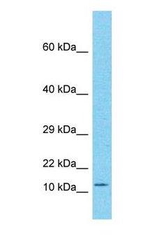 ENY2 Antibody - Western blot of ENY2 Antibody with 293T Whole cell lysate.  This image was taken for the unconjugated form of this product. Other forms have not been tested.