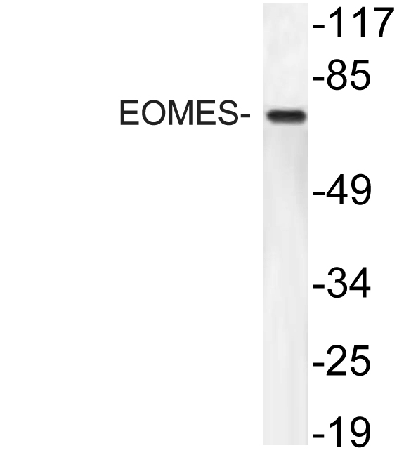 Eomesodermin / EOMES Antibody - Western blot analysis of lysate from HT29 cells, using EOMES antibody.