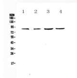Eomesodermin / EOMES Antibody - Western blot - Anti-TBR2/Eomes Picoband antibody