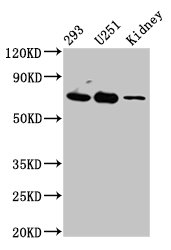 Eomesodermin / EOMES Antibody - Positive Western Blot detected in 293 whole cell lysate, U251 whole cell lysate, Rat kidney tissue. All lanes: EOMES antibody at 4.5 µg/ml Secondary Goat polyclonal to rabbit IgG at 1/50000 dilution. Predicted band size: 73, 48, 46, 75 KDa. Observed band size: 73 KDa