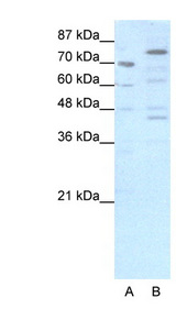 Eomesodermin / EOMES Antibody - EOMES antibody Western blot of HepG2 cell lysate. This image was taken for the unconjugated form of this product. Other forms have not been tested.