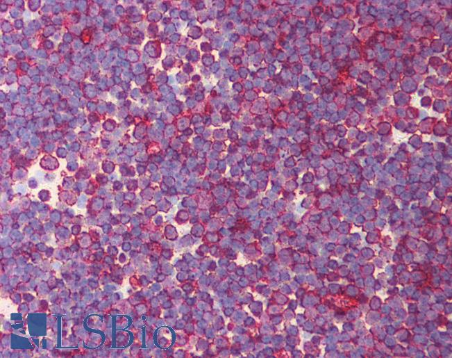 Eomesodermin / EOMES Antibody - Anti-EOMES antibody IHC of human thymus. Immunohistochemistry of formalin-fixed, paraffin-embedded tissue after heat-induced antigen retrieval. Antibody concentration 5 ug/ml.  This image was taken for the unconjugated form of this product. Other forms have not been tested.