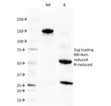 Eosinophil Peroxidase / EPX Antibody - SDS-PAGE Analysis of Purified, BSA-Free Eosinophil Peroxidase Antibody (clone EPO104). Confirmation of Integrity and Purity of the Antibody.