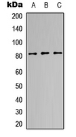Eosinophil Peroxidase / EPX Antibody - Western blot analysis of EPX HC expression in HEK293T (A); NS-1 (B); PC12 (C) whole cell lysates.