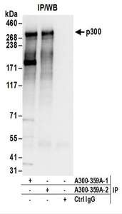 EP300 / p300 Antibody - Detection of Human p300 by Western Blot. Samples: Whole cell lysate (50 ug) from HeLa, 293T, and Jurkat cells. Antibodies: Affinity purified rabbit anti-p300 antibody used for WB at 0.1 ug/ml. Detection: Chemiluminescence with an exposure time of 10 seconds.