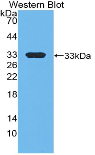 EP300 / p300 Antibody - Western blot of recombinant EP300 / p300.