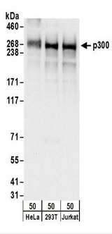 EP300 / p300 Antibody - Detection of Human p300 by Western Blot. Samples: Whole cell lysate (50 ug) from HeLa, 293T, and Jurkat cells. Antibodies: Affinity purified rabbit anti-p300 antibody used for WB at 0.1 ug/ml. Detection: Chemiluminescence with an exposure time of 3 seconds.