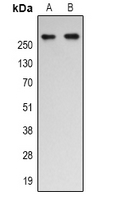 EP300 / p300 Antibody - Western blot analysis of p300 (AcK1542) expression in Jurkat (A); HeLa (B) whole cell lysates.