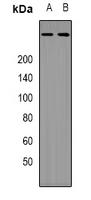 EP300 / p300 Antibody - Western blot analysis of p300 expression in HeLa (A); HEK293T (B) whole cell lysates.