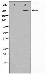 EP300 / p300 Antibody - Western blot of 293 cell lysate using p300 Antibody