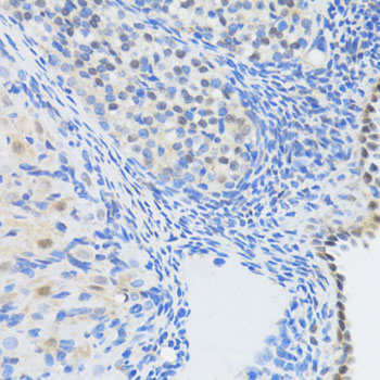 EP300 / p300 Antibody - Immunohistochemistry of paraffin-embedded rat ovary using EP300 antibody at dilution of 1:100 (40x lens).