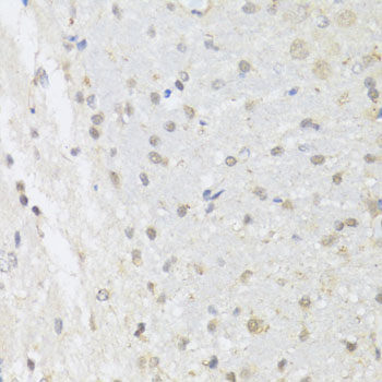 EP300 / p300 Antibody - Immunohistochemistry of paraffin-embedded rat brain using EP300 antibody at dilution of 1:100 (40x lens).
