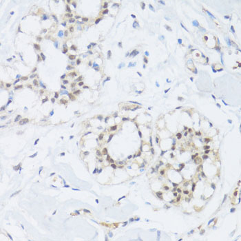 EP300 / p300 Antibody - Immunohistochemistry of paraffin-embedded human breast using EP300 antibody at dilution of 1:100 (40x lens).