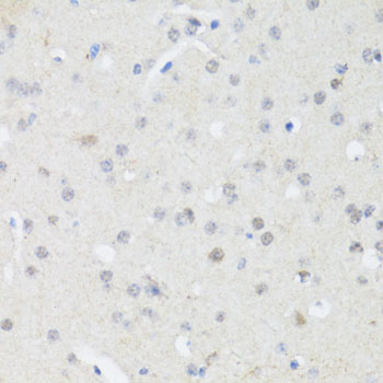 EP300 / p300 Antibody - Immunohistochemistry of paraffin-embedded mouse brain using EP300 antibody at dilution of 1:100 (40x lens).
